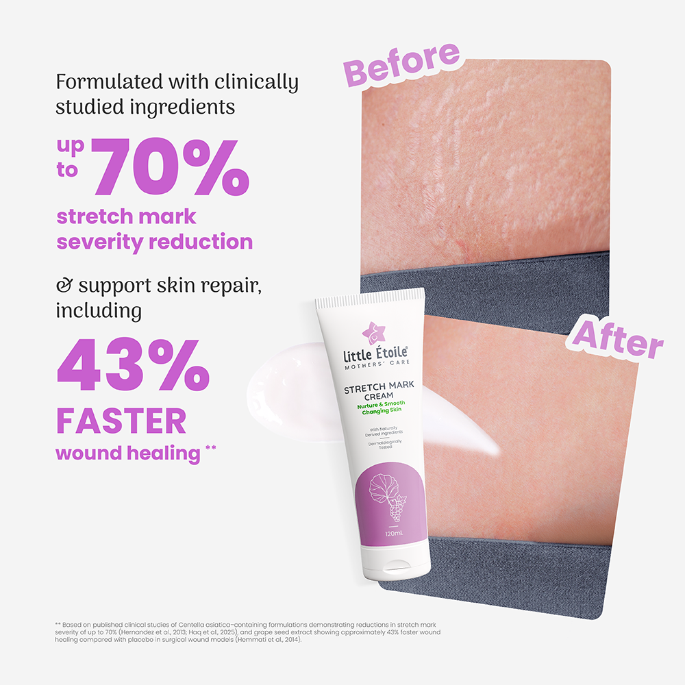 Stretch Mark Cream