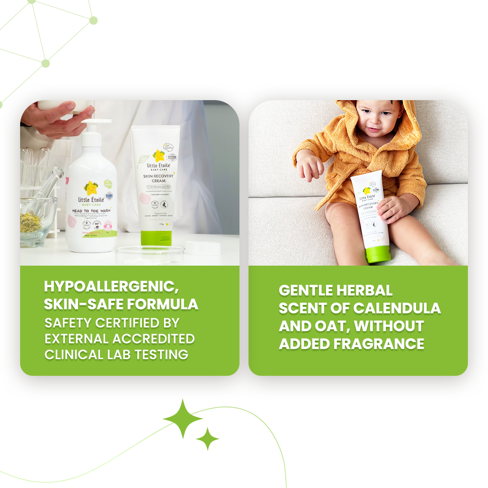 Skin Recovery Cream For Dry & Itchy Skin 170g (0+ Months) (Free Gift)